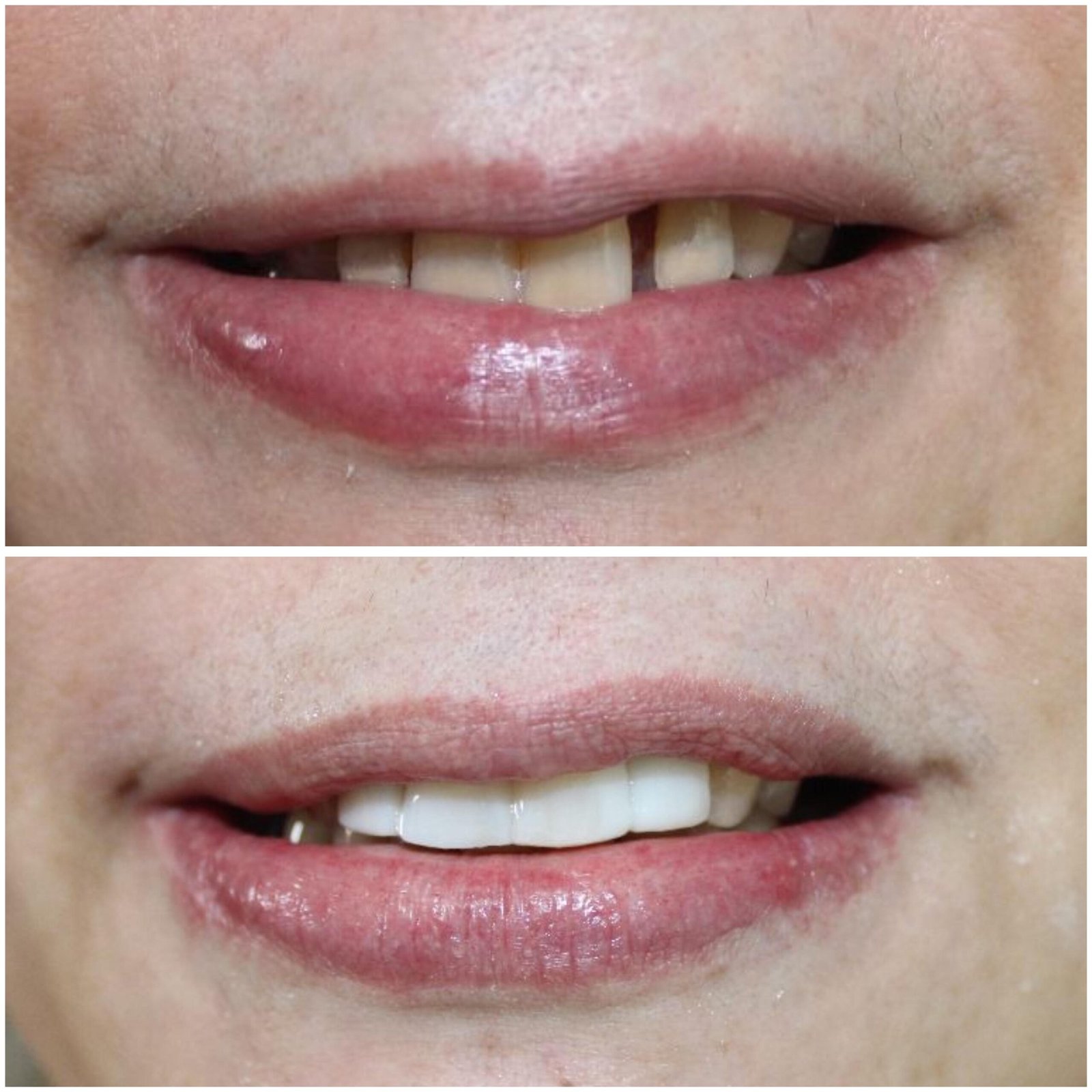 WhatsApp Image 2024-11-16 at 3.41.52 PM WhatsApp Image 2024-11-16 at 3.41.52 PM